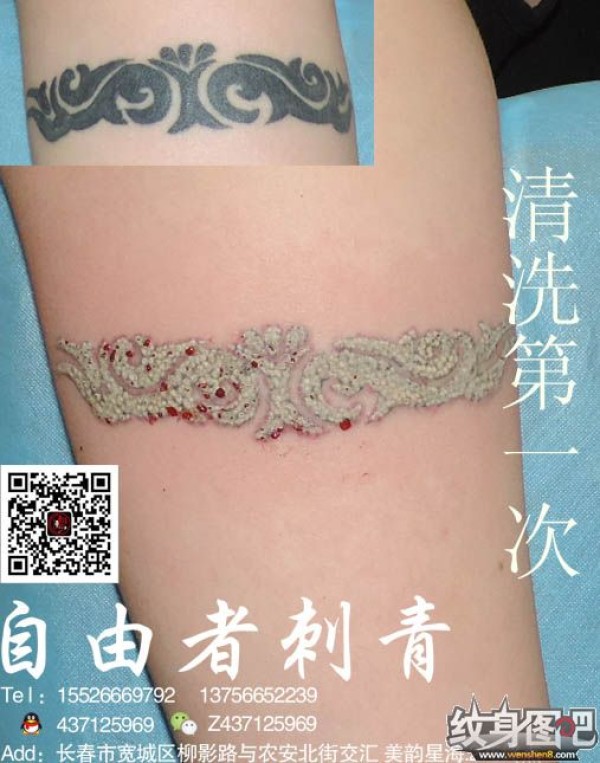 长春清洗纹身 长春自由者刺青