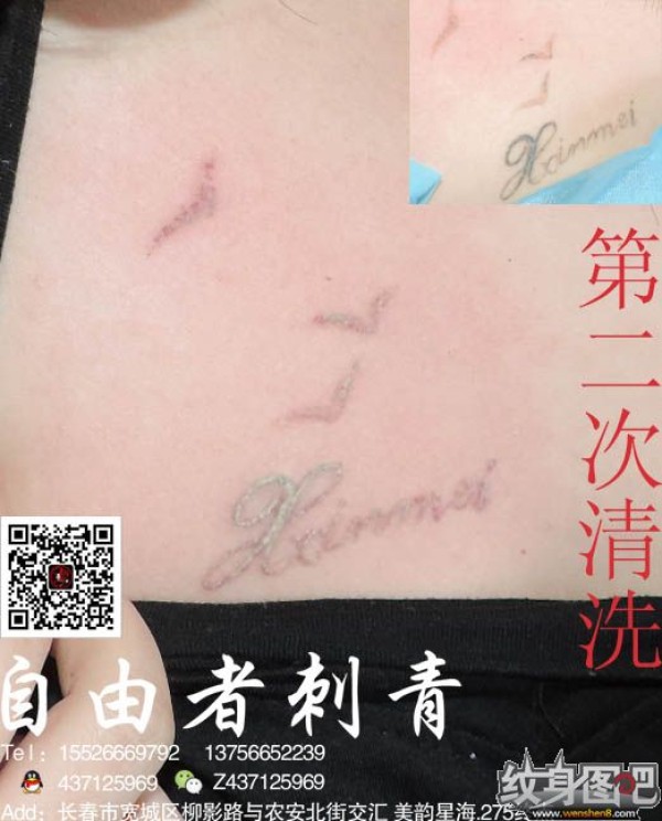 长春清洗纹身 长春自由者刺青