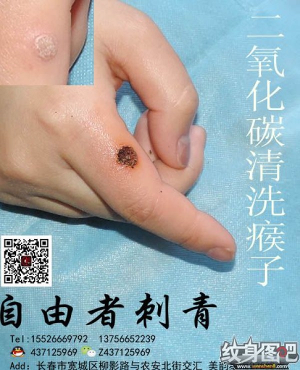 清洗纹身 长春自由者刺青
