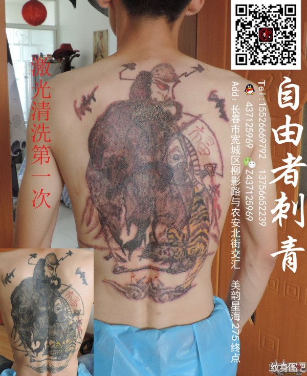 长春清洗纹身   长春自由者刺青