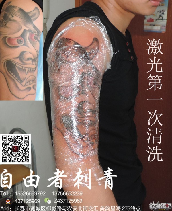 长春清洗纹身   长春自由者刺青