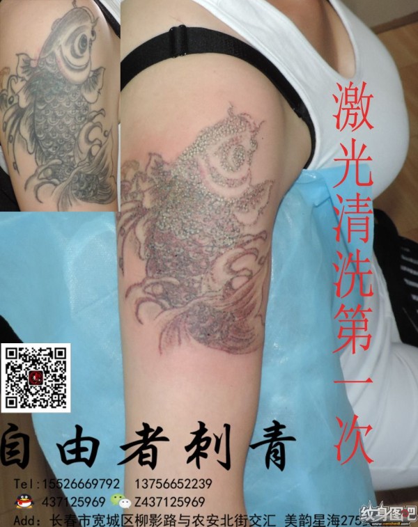 长春清洗纹身   长春自由者刺青