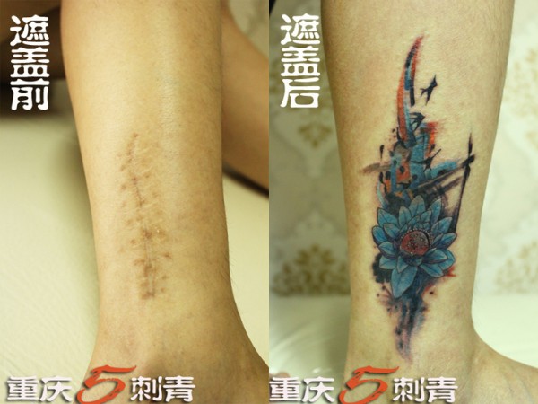 遮盖纹身遮盖以前的一个伤疤，遮盖疤痕必须